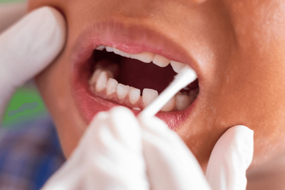 Baby Cavities