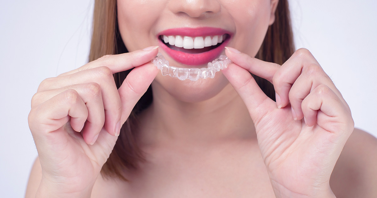 Invisalign